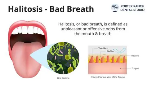 The Level of Knowledge of Patients Visiting the Rantauprapat Health Center for Halitosis